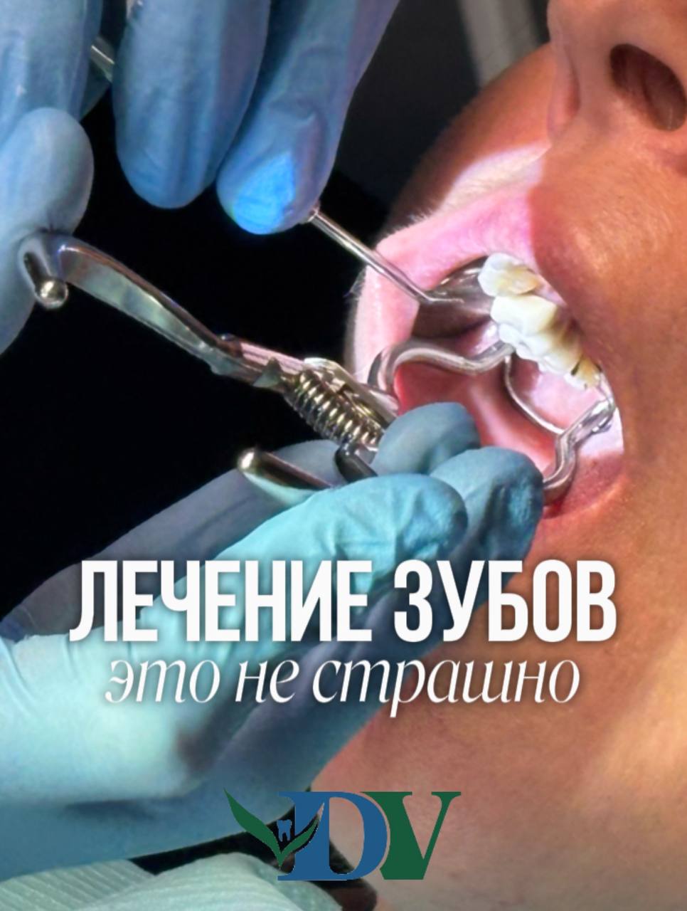 Лечение зубов