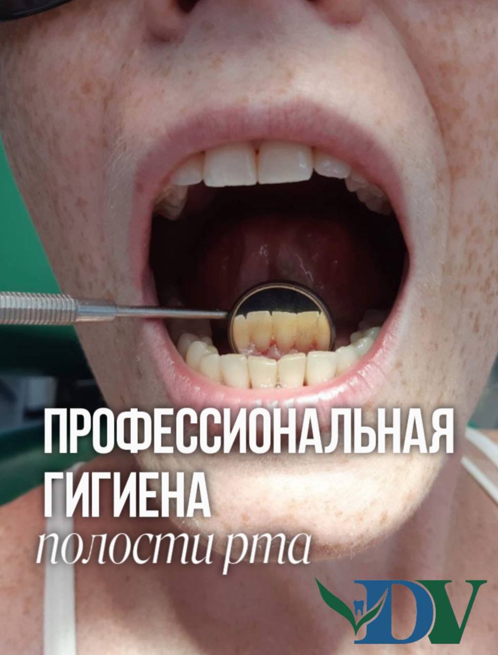 Профессиональная гигиена